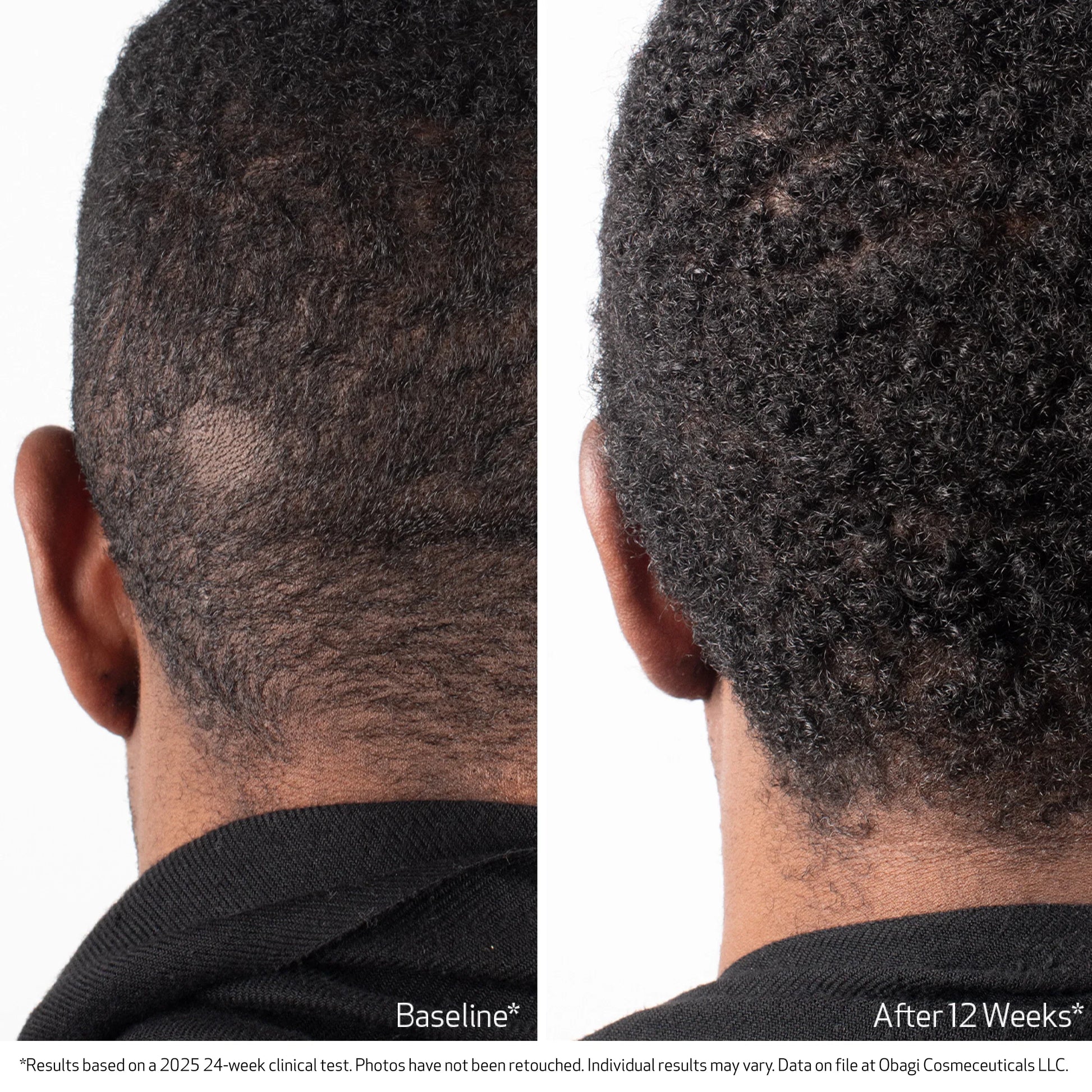 Nu-Cil Biostim Scalp Serum